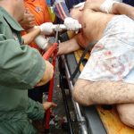 barraceara O corte do ferro foi necessário para o transporte da vítima, pois sua remoção só pode ser feita no centro cirúrgico do Hospital
